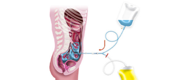 Diagram of a PD exchange: drain, fill, dwell